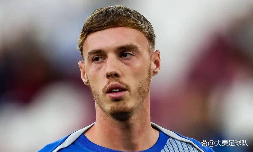 TA：帕尔默因腹股沟伤势将缺阵至11月，将缺席至少4场比赛